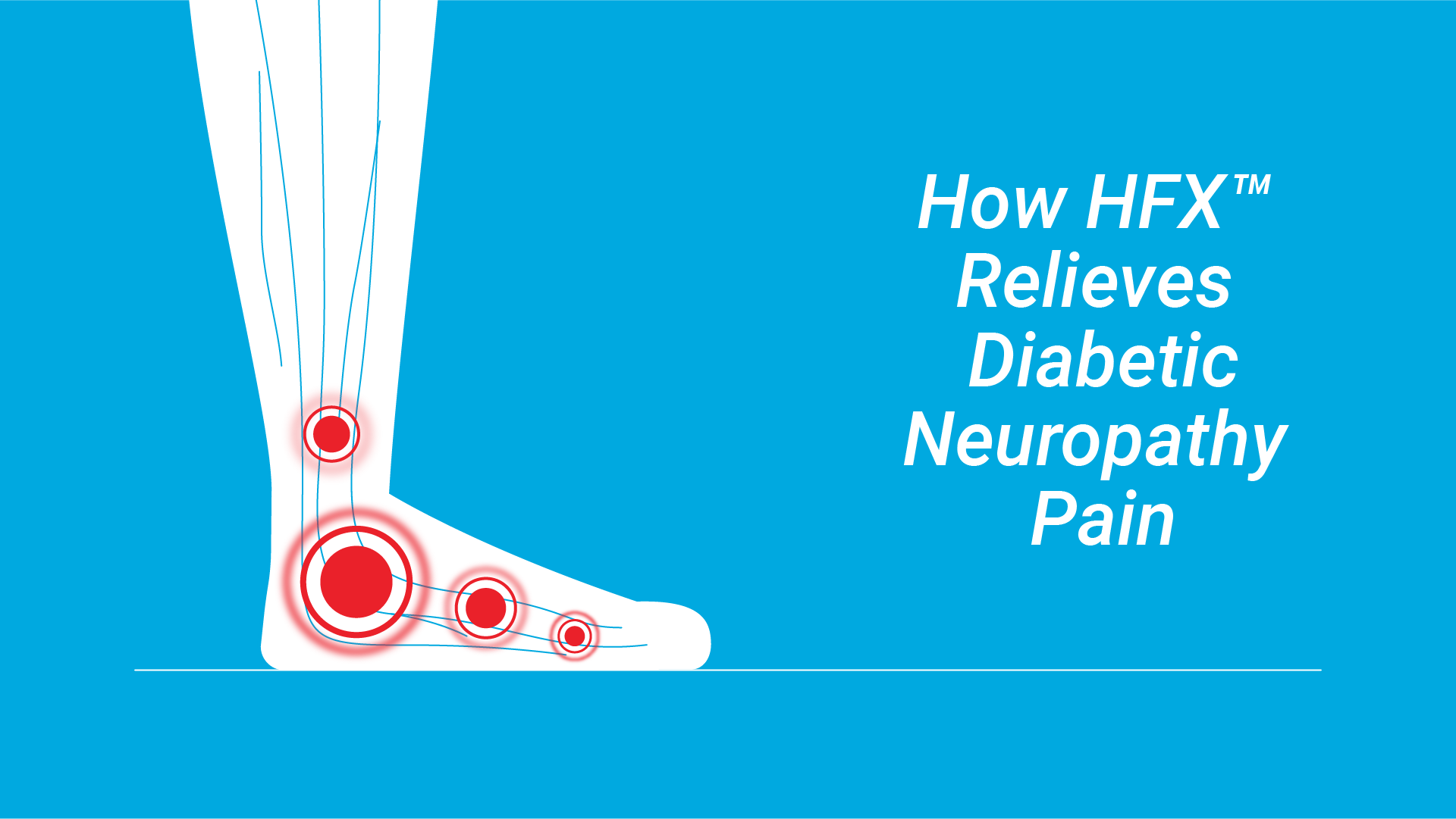 https://uat.hf10-pdn.staging.poundandgrain.ca/app/uploads/2025/07/Video-Thumbnail-HowHFXRelievesDiabeticNeuropathyPain.png